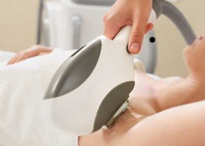 Under Arm Laser Hair Removal