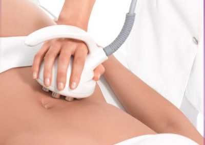 Body Tightening Package of 8 Treatments