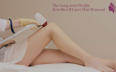 Laser Hair Removal LongTerm Benefits for Skin Health